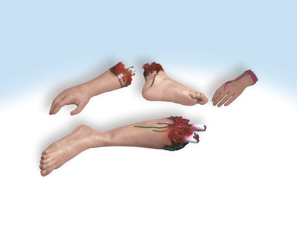 Severed Arm Rubies
